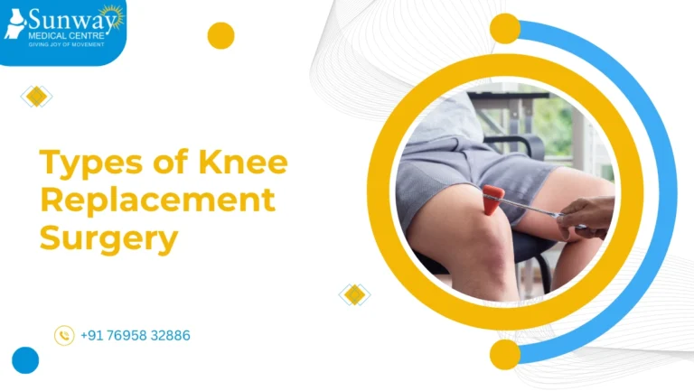 Types of Knee Replacement Surgery