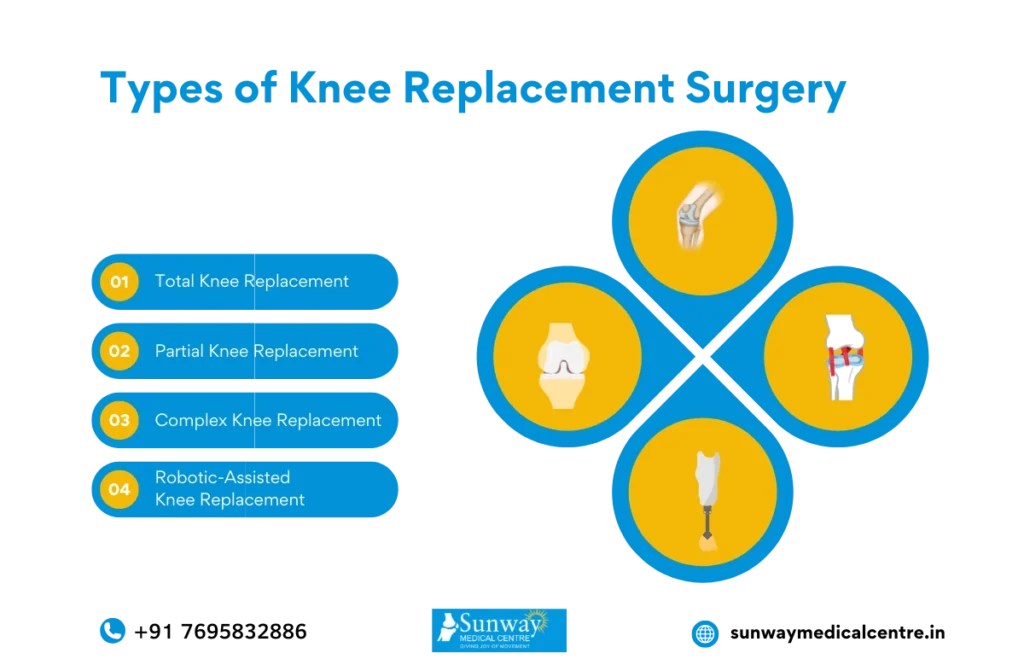 best knee replacement surgeon in chennai